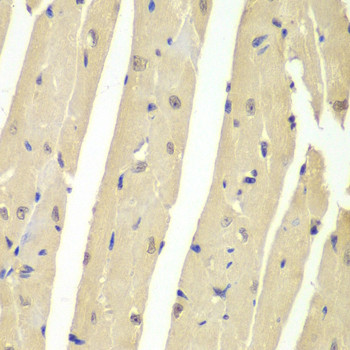 USP7 Antibody in Immunohistochemistry (Paraffin) (IHC (P))