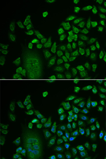 LSM4 Antibody in Immunocytochemistry (ICC/IF)