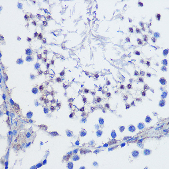 LSM4 Antibody in Immunohistochemistry (Paraffin) (IHC (P))