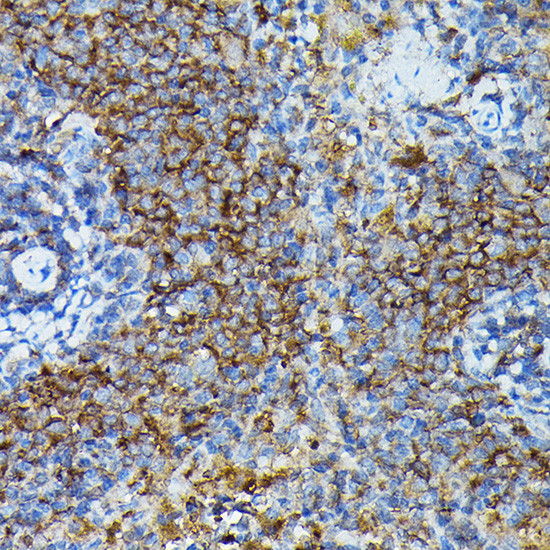 APOBEC3G Antibody in Immunohistochemistry (Paraffin) (IHC (P))