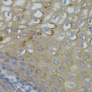 MFN2 Antibody in Immunohistochemistry (Paraffin) (IHC (P))