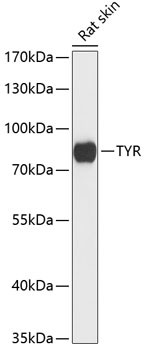 Tyrosinase Antibody in Western Blot (WB)