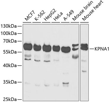 KPNA1 Antibody in Western Blot (WB)