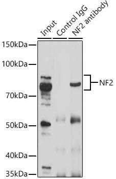 NF2 Antibody in Immunoprecipitation (IP)