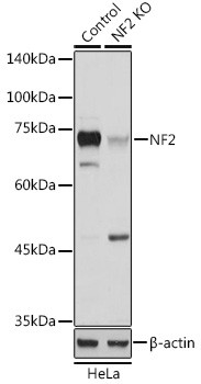 NF2 Antibody in Western Blot (WB)