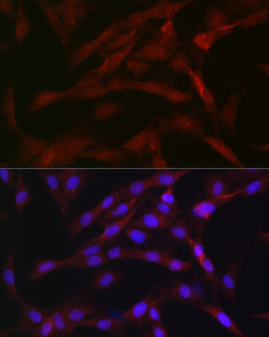 PKC beta-1,2 Antibody in Immunocytochemistry (ICC/IF)