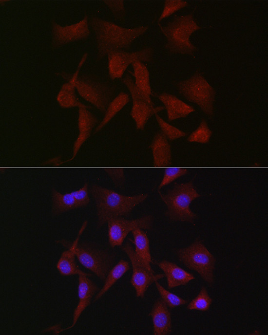 PKC beta-1,2 Antibody in Immunocytochemistry (ICC/IF)