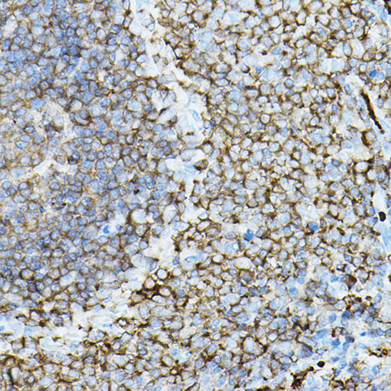 PKC beta-1,2 Antibody in Immunohistochemistry (Paraffin) (IHC (P))