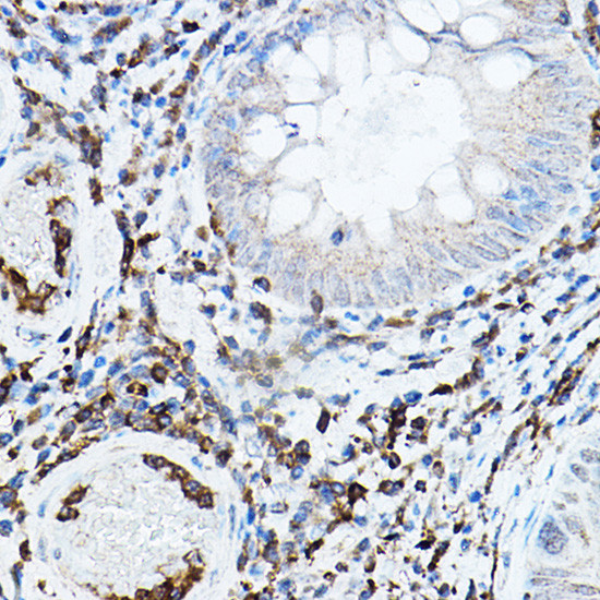 PKC beta-1,2 Antibody in Immunohistochemistry (Paraffin) (IHC (P))