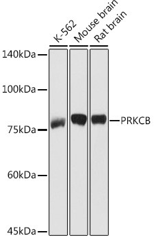 PKC beta-1,2 Antibody in Western Blot (WB)