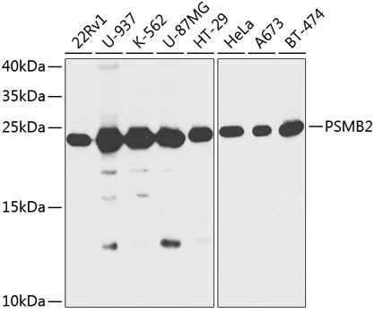 PSMB2 Antibody in Western Blot (WB)