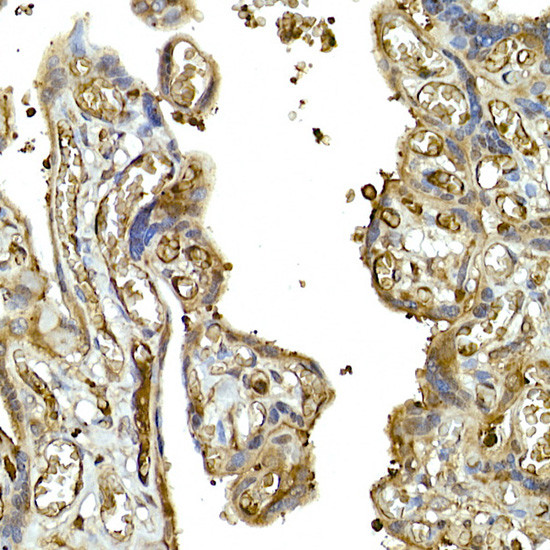 MDA5 Antibody in Immunohistochemistry (Paraffin) (IHC (P))