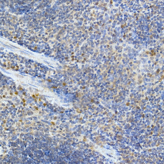 MDA5 Antibody in Immunohistochemistry (Paraffin) (IHC (P))