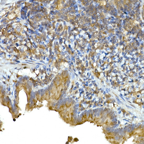 MDA5 Antibody in Immunohistochemistry (Paraffin) (IHC (P))