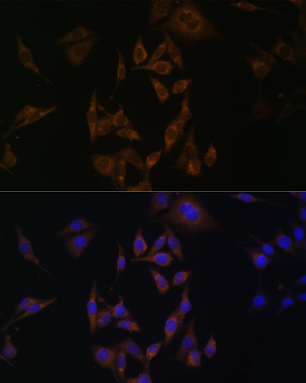 UBE2L6 Antibody in Immunocytochemistry (ICC/IF)