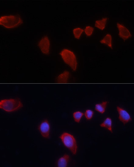 Carbonic Anhydrase IX Antibody in Immunocytochemistry (ICC/IF)