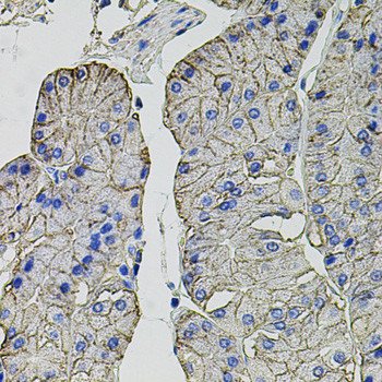 Carbonic Anhydrase IX Antibody in Immunohistochemistry (Paraffin) (IHC (P))