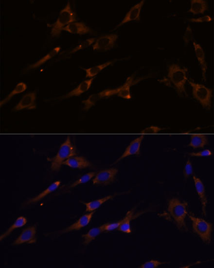 RPL7A Antibody in Immunocytochemistry (ICC/IF)