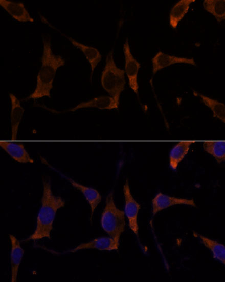 RPL7A Antibody in Immunocytochemistry (ICC/IF)