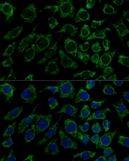 IDH3B Antibody in Immunocytochemistry (ICC/IF)