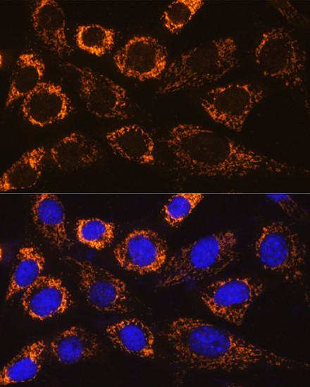 P4HA3 Antibody in Immunocytochemistry (ICC/IF)