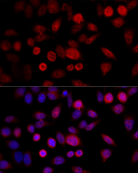 CYP1B1 Antibody in Immunocytochemistry (ICC/IF)