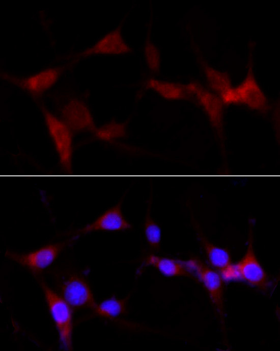 CYP1B1 Antibody in Immunocytochemistry (ICC/IF)