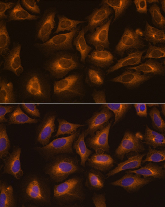 KARS Antibody in Immunocytochemistry (ICC/IF)