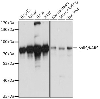 KARS Antibody in Western Blot (WB)