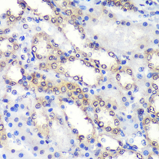 PSME4 Antibody in Immunohistochemistry (Paraffin) (IHC (P))