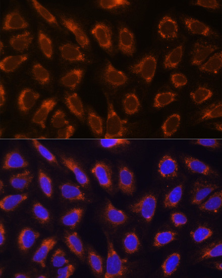 GANAB Antibody in Immunocytochemistry (ICC/IF)