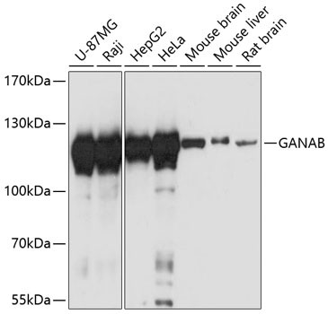 GANAB Antibody in Western Blot (WB)
