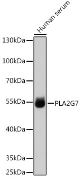 PLA2G7 Antibody in Western Blot (WB)