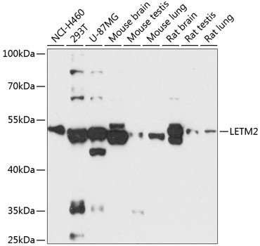 LETM2 Antibody in Western Blot (WB)