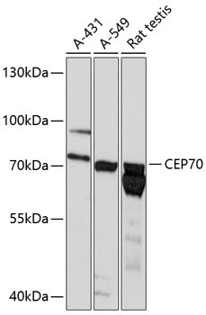 BITE Antibody in Western Blot (WB)