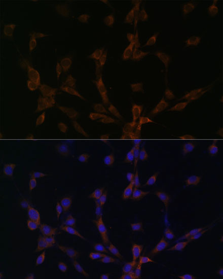 Dynein Antibody in Immunocytochemistry (ICC/IF)