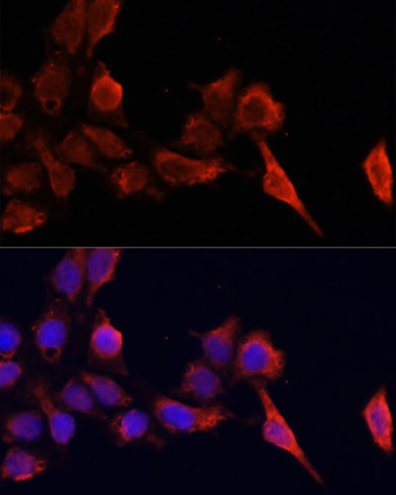 TIMP1 Antibody in Immunocytochemistry (ICC/IF)