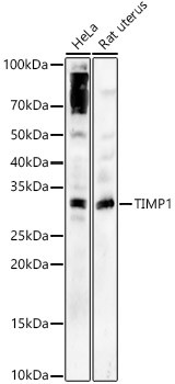 TIMP1 Antibody in Western Blot (WB)