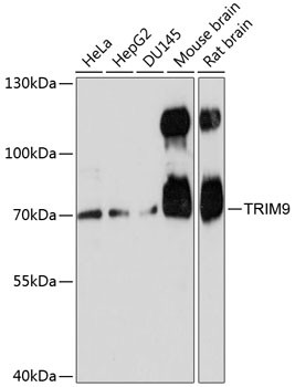 TRIM9 Antibody in Western Blot (WB)