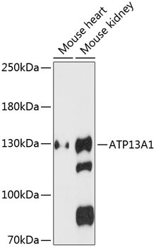 ATP13A1 Antibody in Western Blot (WB)