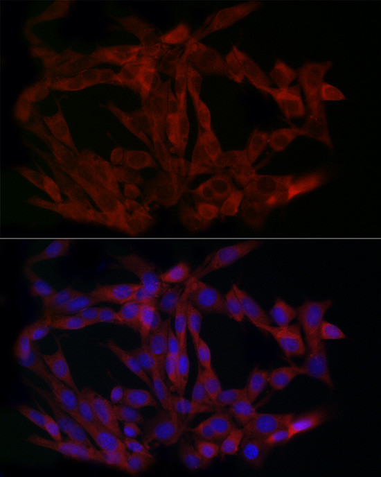 LIMS1 Antibody in Immunocytochemistry (ICC/IF)