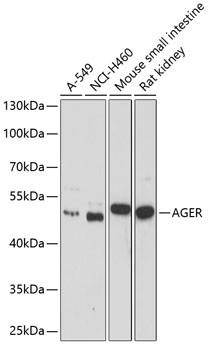 RAGE Antibody in Western Blot (WB)