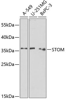 Stomatin Antibody in Western Blot (WB)