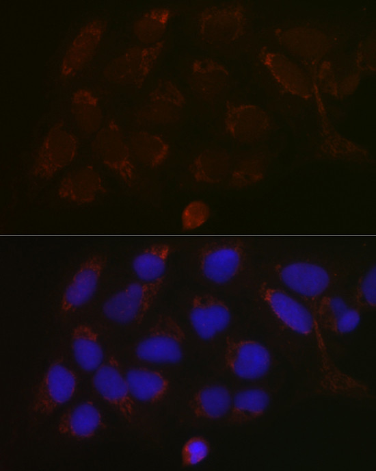 GALNT3 Antibody in Immunocytochemistry (ICC/IF)