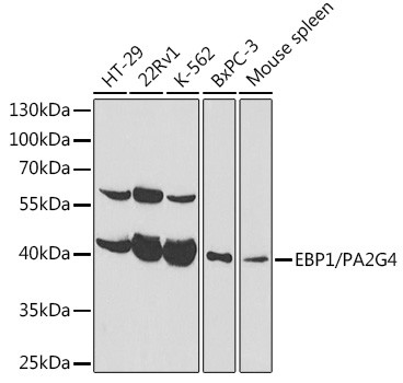 EBP1 Antibody in Western Blot (WB)