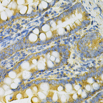 PGK1 Antibody in Immunohistochemistry (Paraffin) (IHC (P))