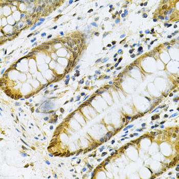 PGK1 Antibody in Immunohistochemistry (Paraffin) (IHC (P))