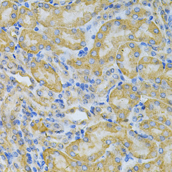 PGK1 Antibody in Immunohistochemistry (Paraffin) (IHC (P))