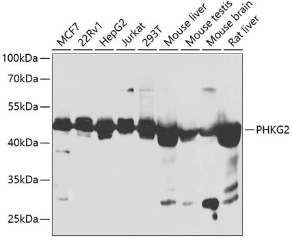 PHKG2 Antibody in Western Blot (WB)