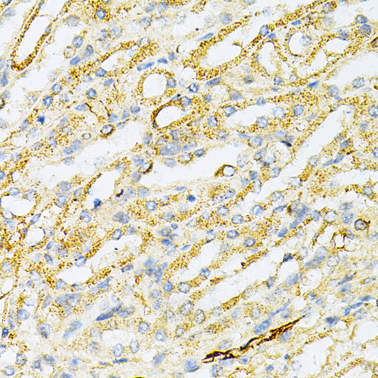 SULT2A1 Antibody in Immunohistochemistry (Paraffin) (IHC (P))